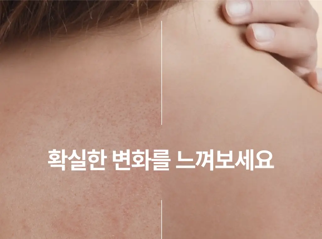 [극건성용] 아비노 더멕사 아토 바디크림 200ml 상세페이지 13